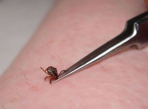 Proper Tick Removal