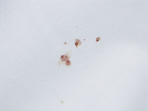 bed-bug-stains