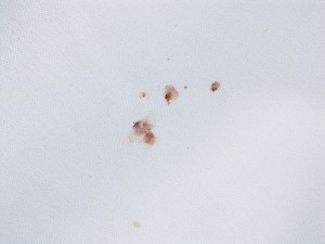 bed-bug-stains
