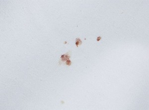 bedbug-blood-stains