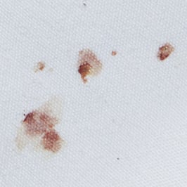 bed-bug-blood-stains