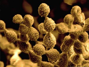 CT  MET-AJ-MOLD-CLADOSPORIUM