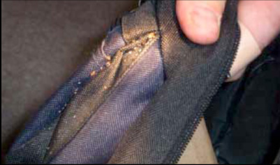 bedbugs-on-a-backpack