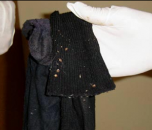 bed-bugs-on-sock