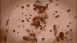 bedbugs73